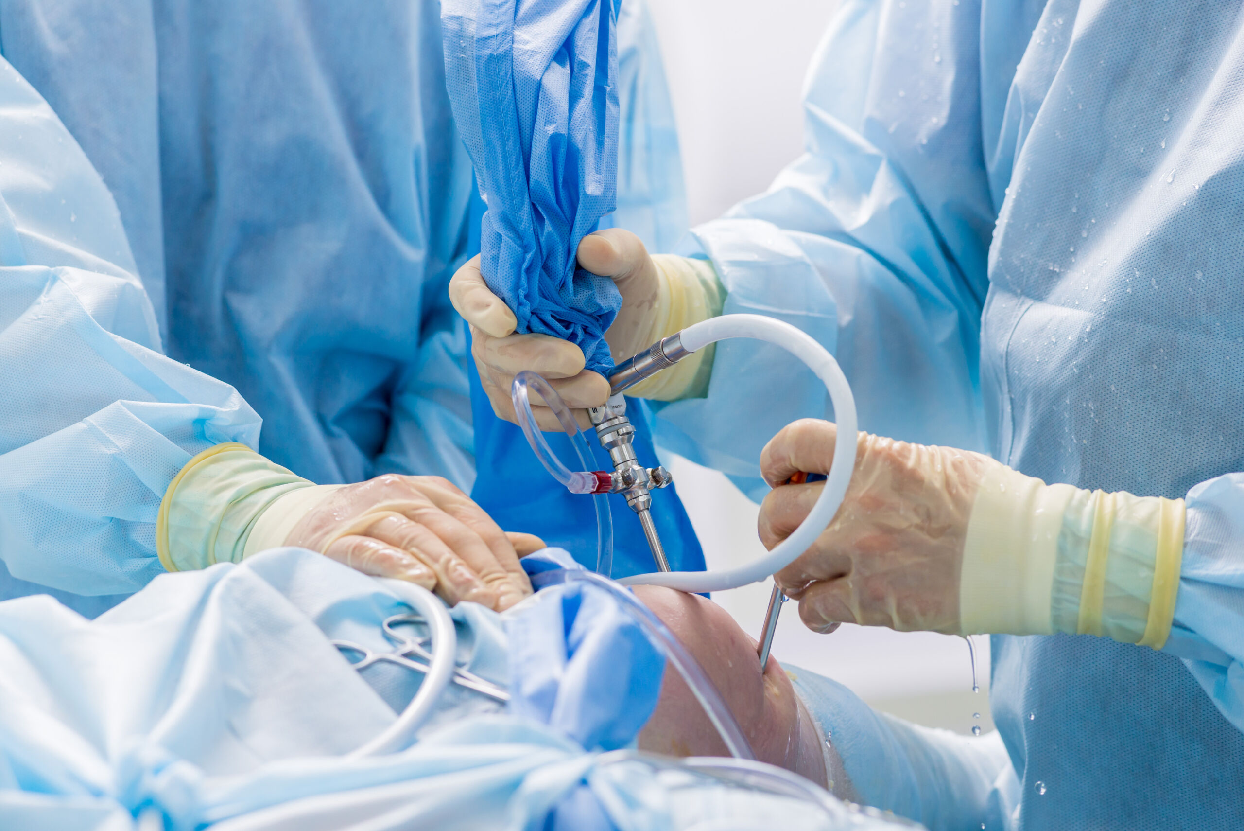 Knee surgery